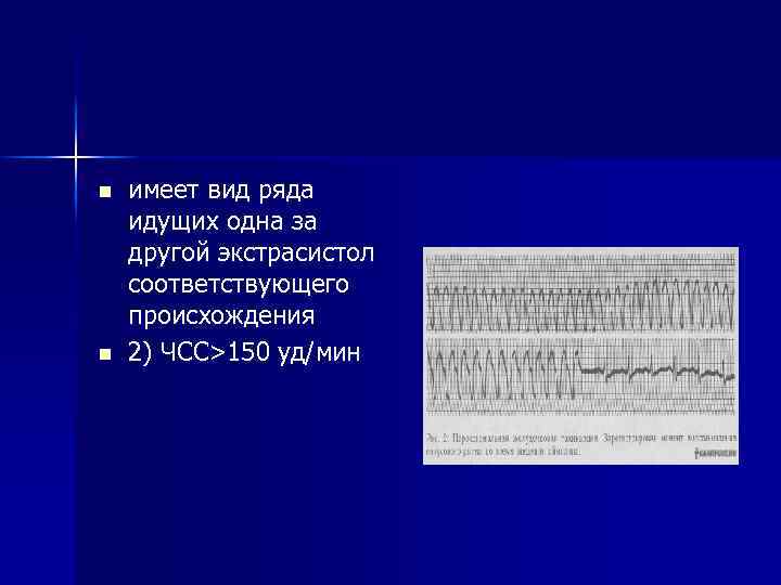 n n имеет вид ряда идущих одна за другой экстрасистол соответствующего происхождения 2) ЧСС>150