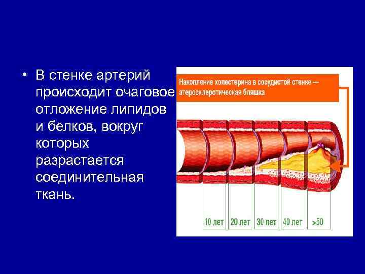 Артериальные стенки. Белки в сосудистой стенке. Оболочки сосудистой стенки. Стенки артерий.