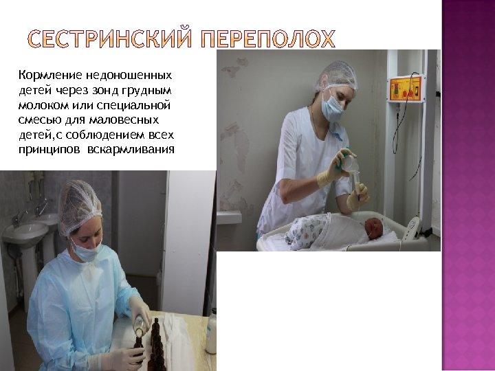 Кормление недоношенных детей через зонд грудным молоком или специальной смесью для маловесных детей, с