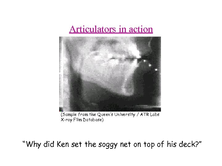 Articulators in action (Sample from the Queen’s University / ATR Labs X-ray Film Database)