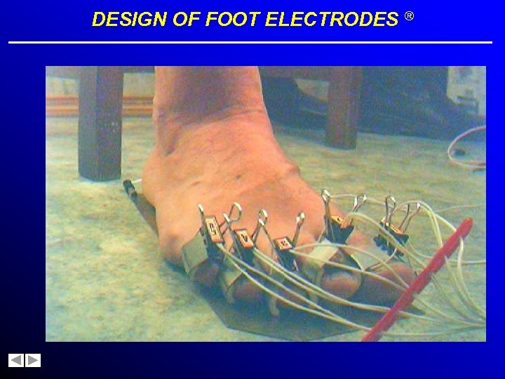 DESIGN OF FOOT ELECTRODES ® 