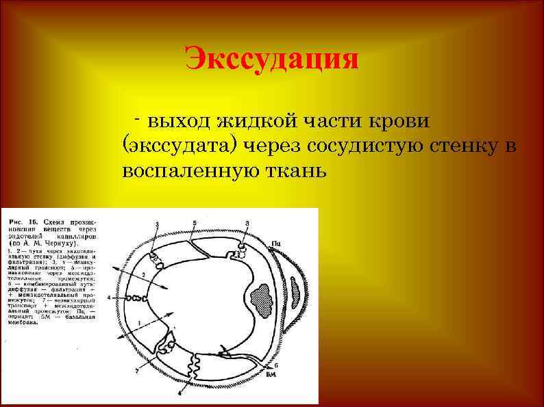 Экссудация - выход жидкой части крови (экссудата) через сосудистую стенку в воспаленную ткань. 