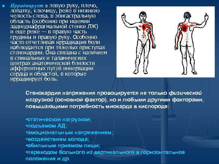 n Иррадиирует в левую руку, плечо, лопатку, ключицу, реже в нижнюю челюсть слева, в