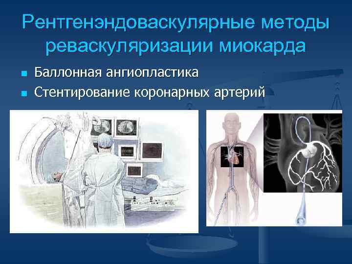 Рентгенэндоваскулярные методы реваскуляризации миокарда n n Баллонная ангиопластика Стентирование коронарных артерий 