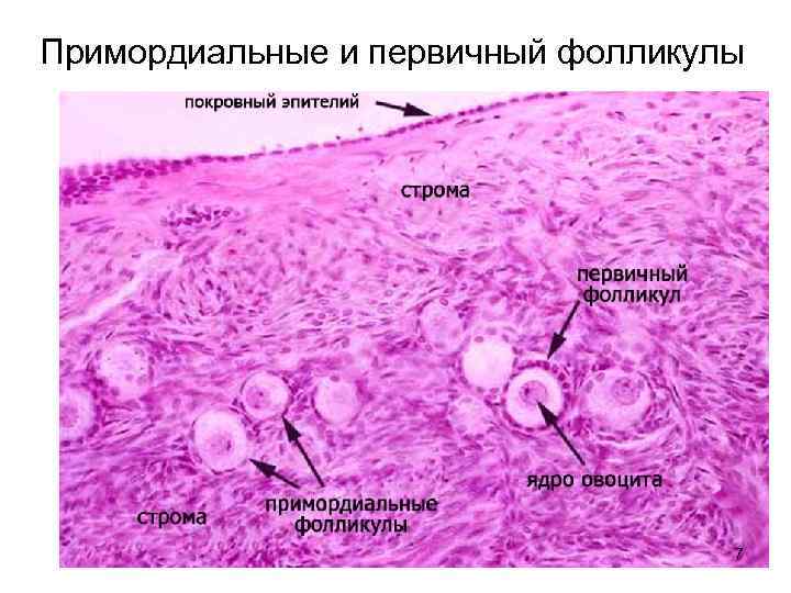 Примордиальные и первичный фолликулы 7 