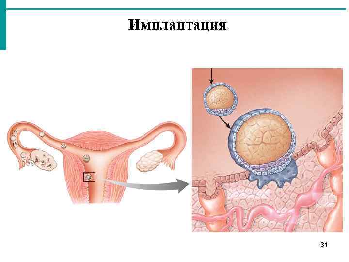 Имплантация 31 