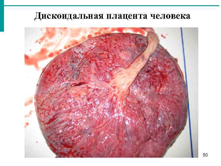 Дискоидальная плацента человека 50 