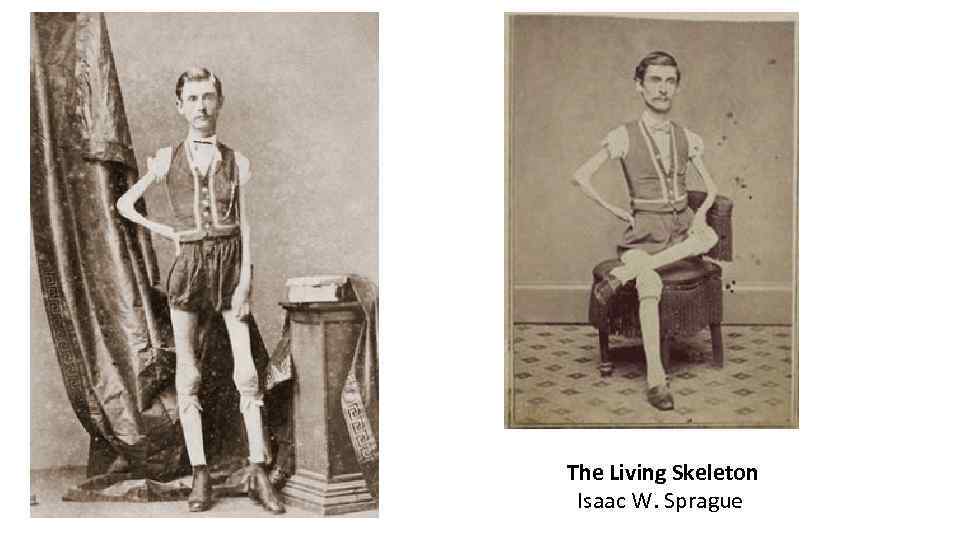 The Living Skeleton Isaac W. Sprague 