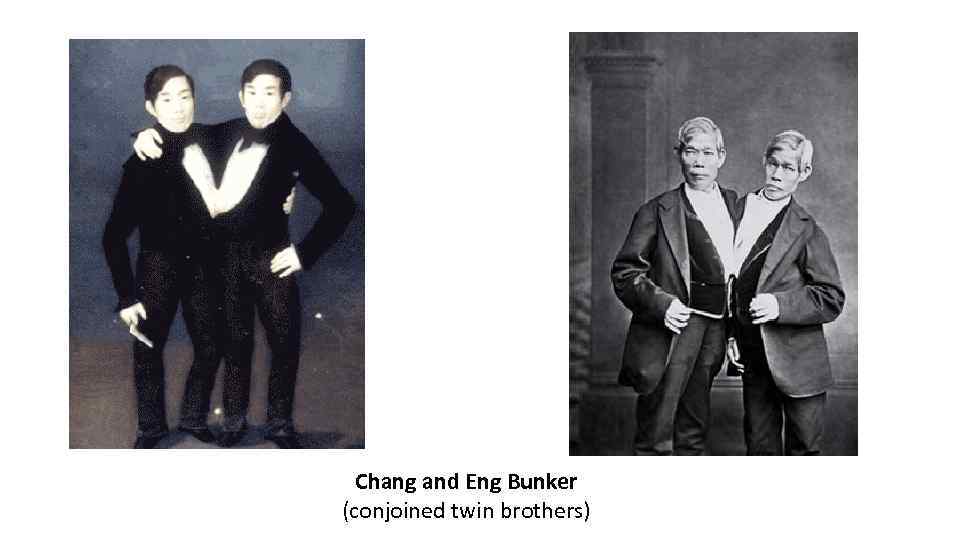 Chang and Eng Bunker (conjoined twin brothers) 