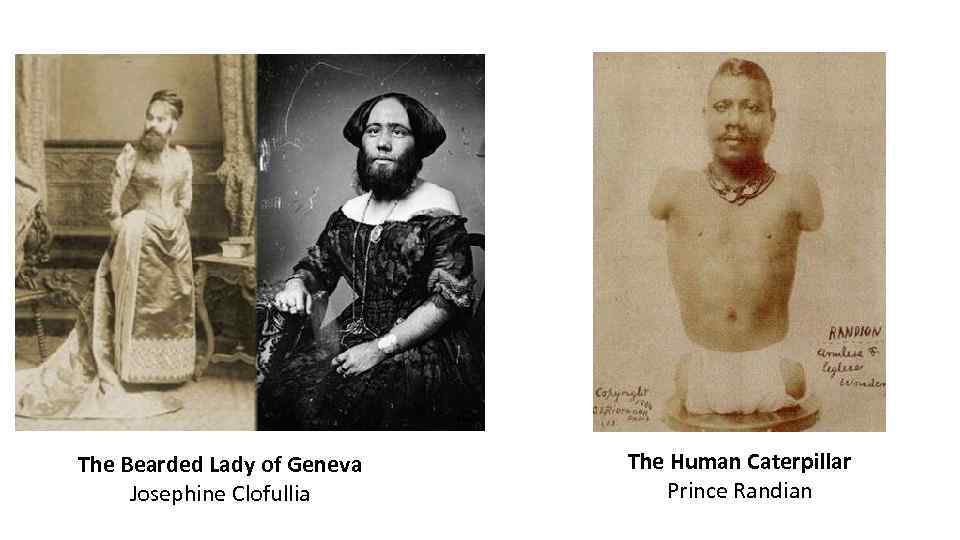 The Bearded Lady of Geneva Josephine Clofullia The Human Caterpillar Prince Randian 