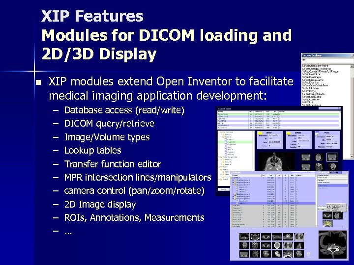 XIP Features Modules for DICOM loading and 2 D/3 D Display n XIP modules