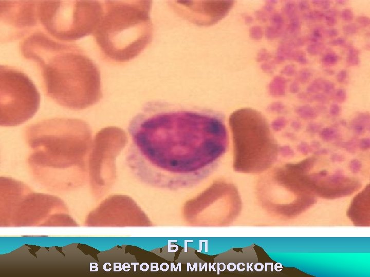 БГЛ в световом микроскопе 
