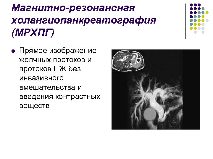 Магнитно-резонансная холангиопанкреатография (МРХПГ) l Прямое изображение желчных протоков и протоков ПЖ без инвазивного вмешательства