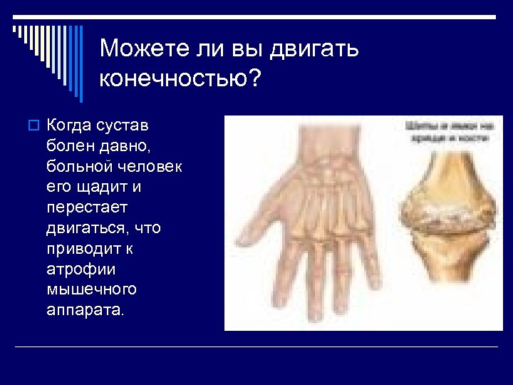 Можете ли вы двигать конечностью? o Когда сустав болен давно, больной человек его щадит