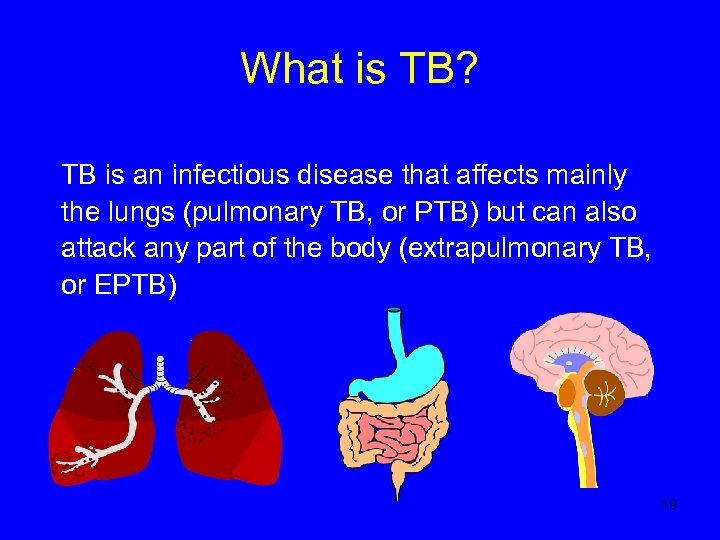 What is TB? TB is an infectious disease that affects mainly the lungs (pulmonary