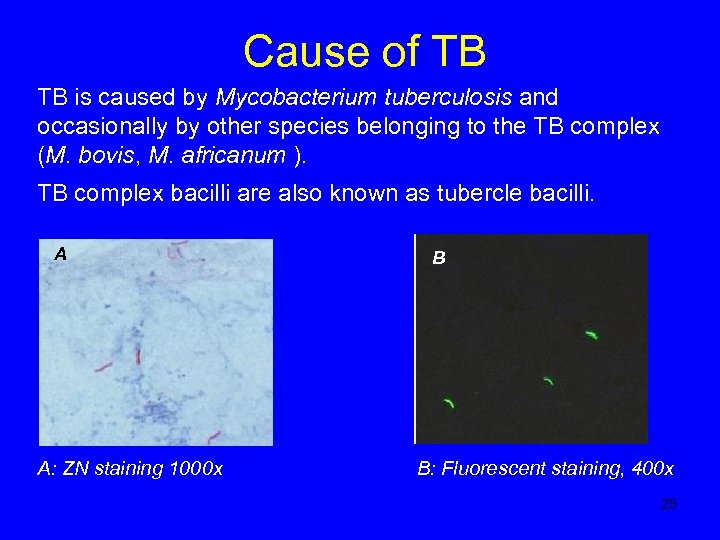 Cause of TB TB is caused by Mycobacterium tuberculosis and occasionally by other species