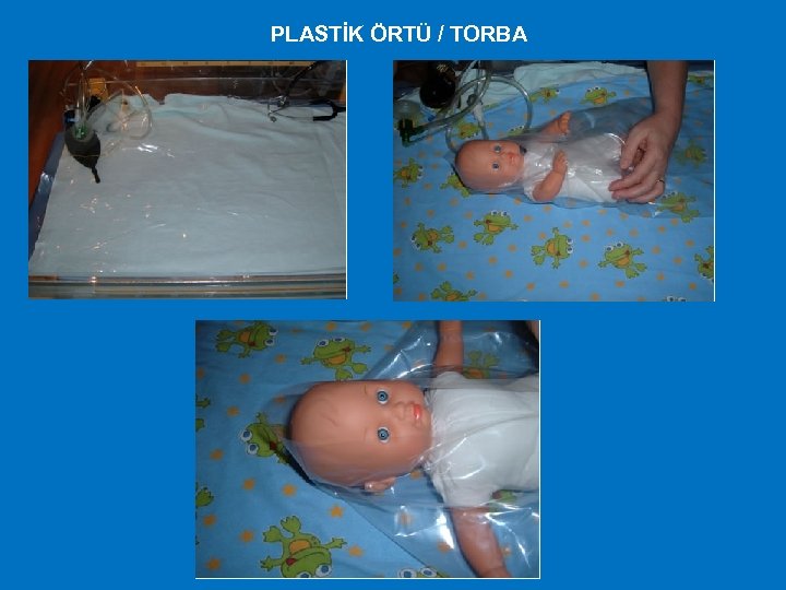 PLASTİK ÖRTÜ / TORBA 