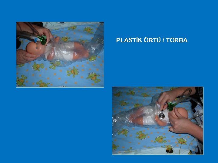 PLASTİK ÖRTÜ / TORBA 