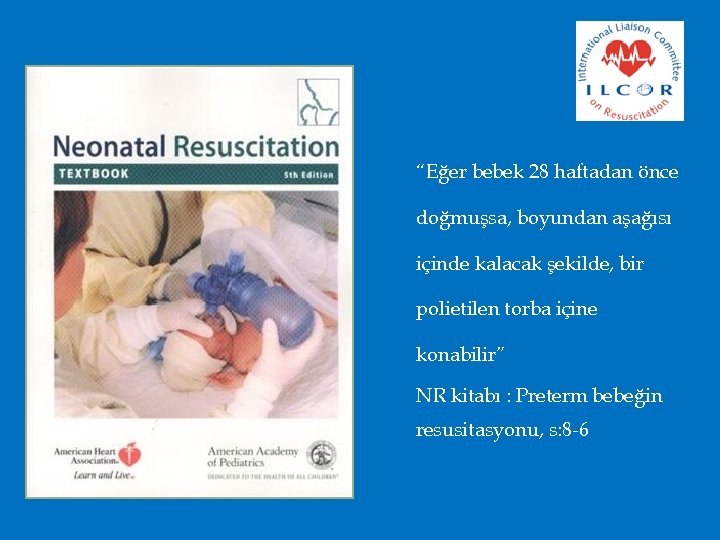 “Eğer bebek 28 haftadan önce doğmuşsa, boyundan aşağısı içinde kalacak şekilde, bir polietilen torba