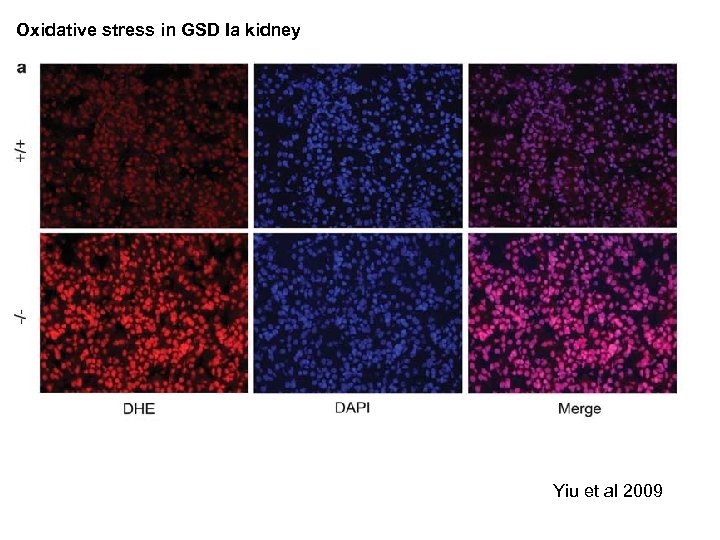 Oxidative stress in GSD Ia kidney Yiu et al 2009 