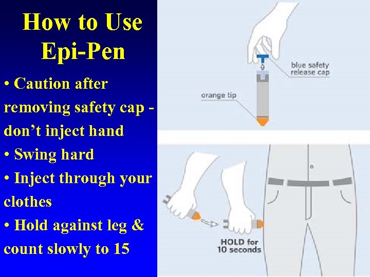 How to Use Epi-Pen • Caution after removing safety cap don’t inject hand •