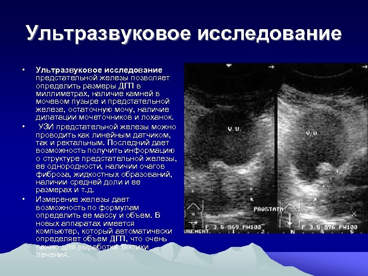Ультразвуковое исследование • • • Ультразвуковое исследование предстательной железы позволяет определить размеры ДГП в