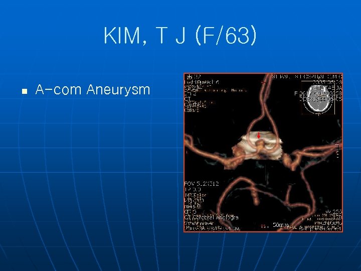 KIM, T J (F/63) n A-com Aneurysm 