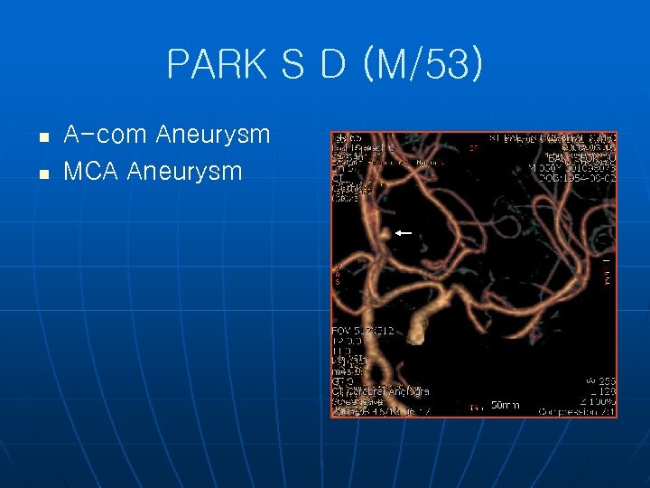 PARK S D (M/53) n n A-com Aneurysm MCA Aneurysm 