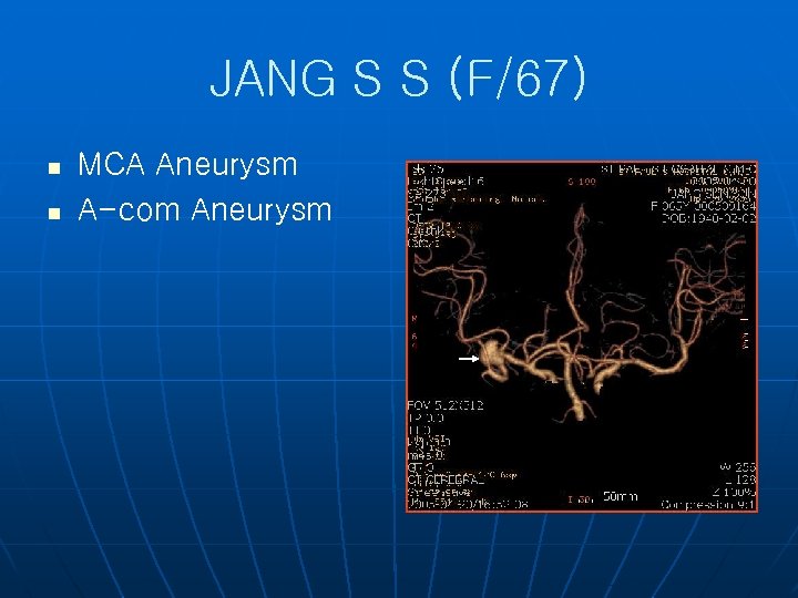 JANG S S (F/67) n n MCA Aneurysm A-com Aneurysm 