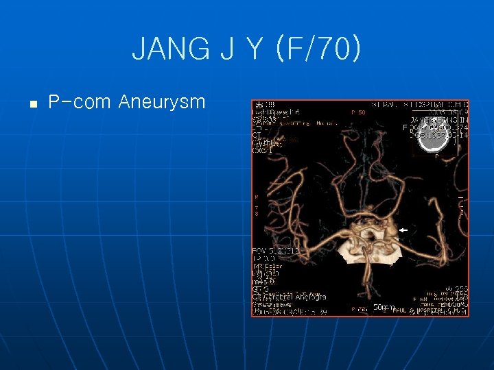 JANG J Y (F/70) n P-com Aneurysm 