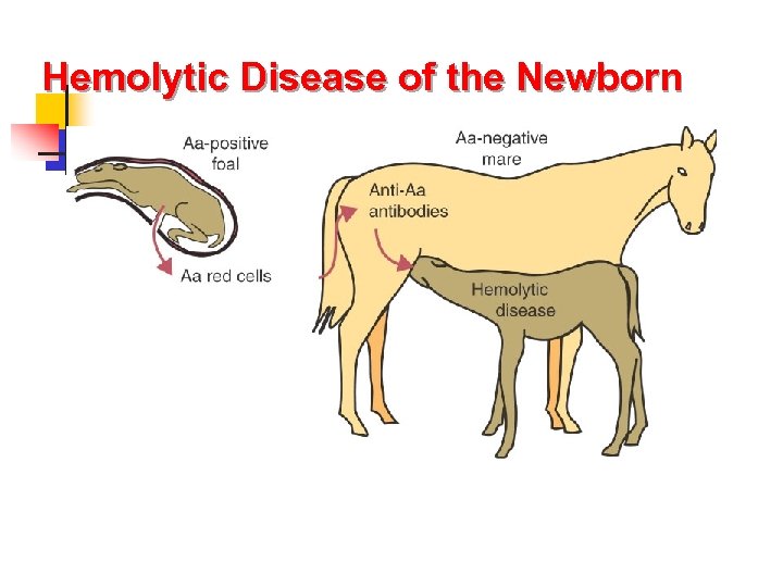 Hemolytic Disease of the Newborn 