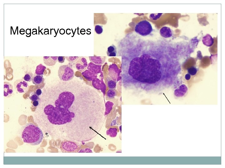 Megakaryocytes 