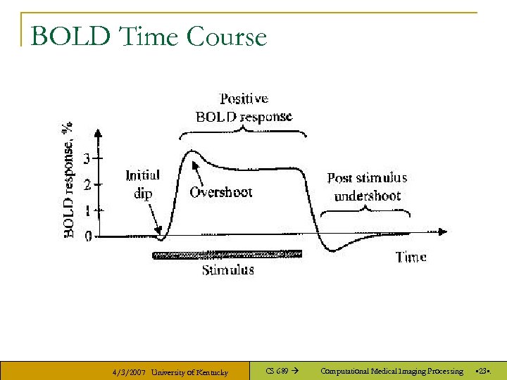 BOLD Time Course 4/3/2007 University of Kentucky CS 689 Computational Medical Imaging Processing •