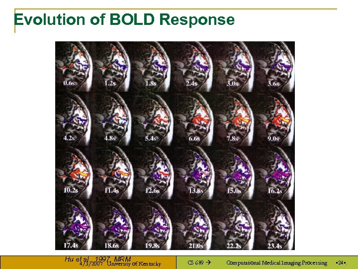 Evolution of BOLD Response Hu et al. , 1997, MRM 4/3/2007 University of Kentucky