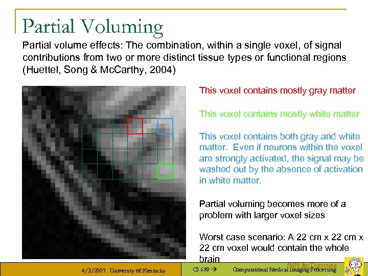 Partial Voluming Partial volume effects: The combination, within a single voxel, of signal contributions