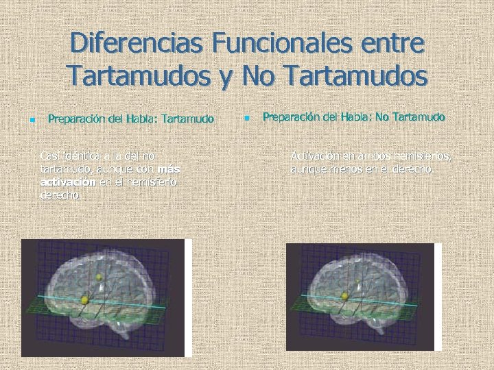 Diferencias Funcionales entre Tartamudos y No Tartamudos n Preparación del Habla: Tartamudo Casi idéntica