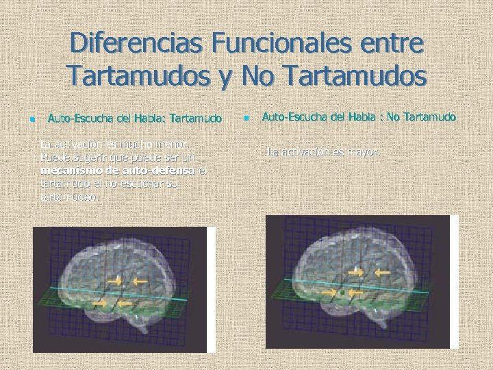 Diferencias Funcionales entre Tartamudos y No Tartamudos n Auto-Escucha del Habla: Tartamudo La activación
