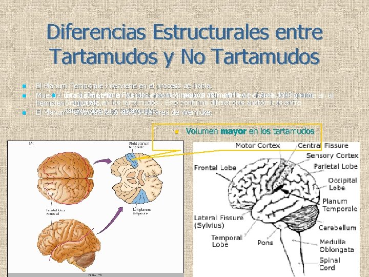 Diferencias Estructurales entre Tartamudos y No Tartamudos n n n El Planum Temporale interviene