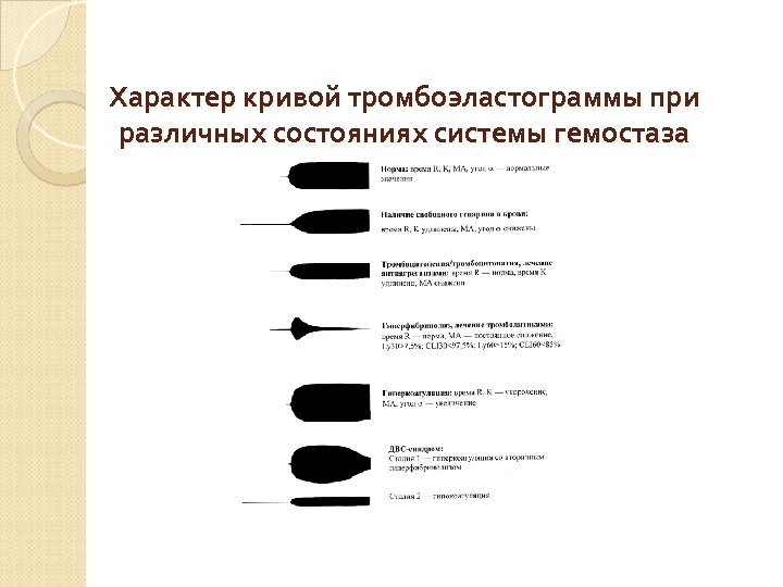 Характер кривой тромбоэластограммы при различных состояниях системы гемостаза 