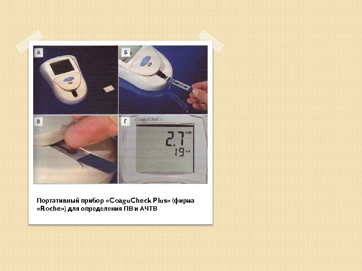 Портативный прибор «Coagu. Check Plus» (фирма «Roche» ) для определения ПВ и АЧТВ 