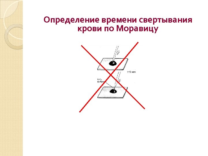 Определение времени свертывания крови по Моравицу 