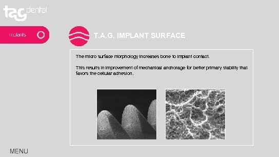 T. A. G. IMPLANT SURFACE The micro surface morphology increases bone to implant contact.
