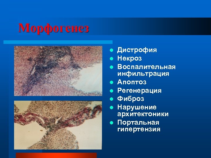 Морфогенез l l l l Дистрофия Некроз Воспалительная инфильтрация Апоптоз Регенерация Фиброз Нарушение архитектоники