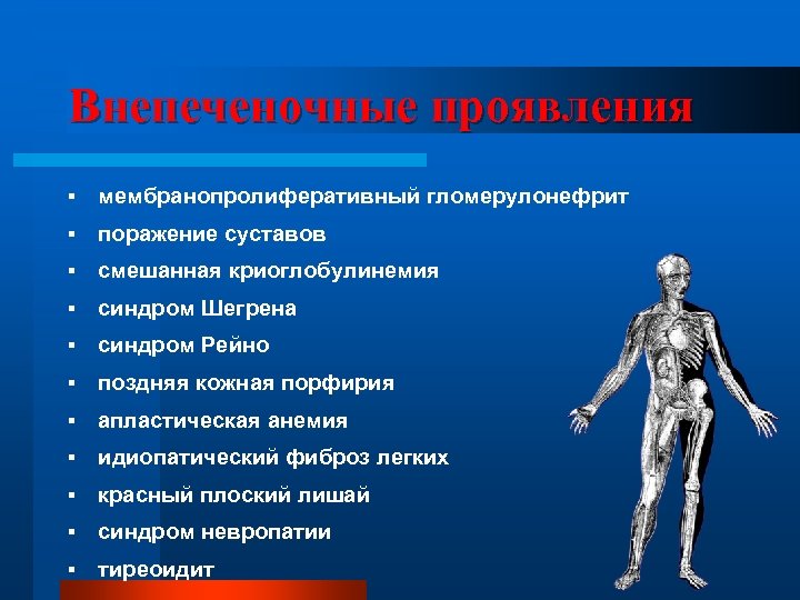 Внепеченочные проявления § мембранопролиферативный гломерулонефрит § поражение суставов § смешанная криоглобулинемия § синдром Шегрена