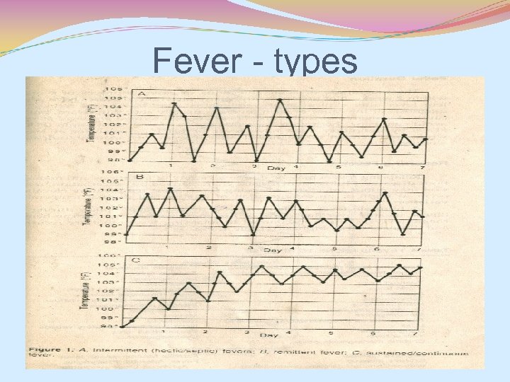 Fever - types 