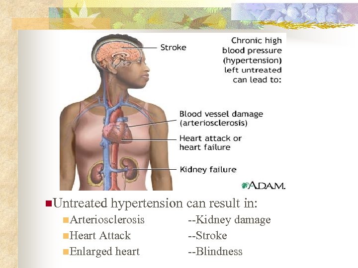 n. Untreated hypertension can result in: n. Arteriosclerosis n. Heart Attack n. Enlarged heart