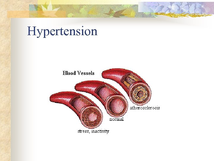 Hypertension 