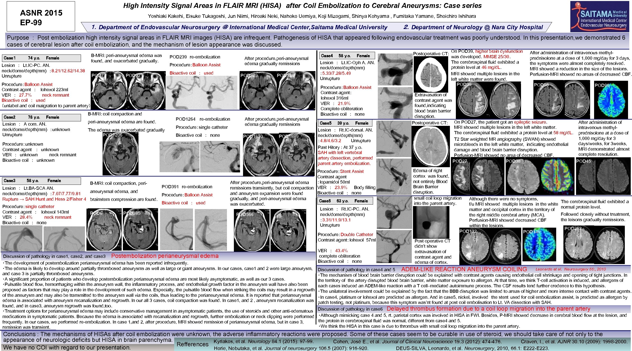 ASNR 2015 EP-99 High Intensity Signal Areas in FLAIR MRI (HISA)　after Coil Embolization to