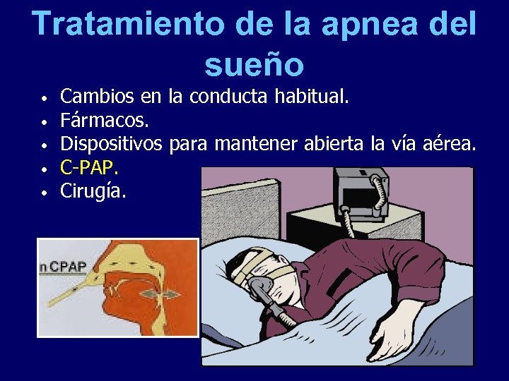 Tratamiento de la apnea del sueño • • • Cambios en la conducta habitual.