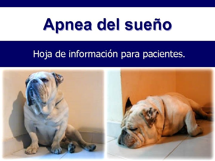 Apnea del sueño Hoja de información para pacientes. 